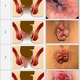 Illustration for article titled Obat Wasir Ambeien Herbal